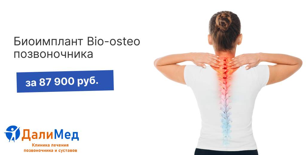 Биоимплант Bio-osteo позвоночника за 87 900 рублей