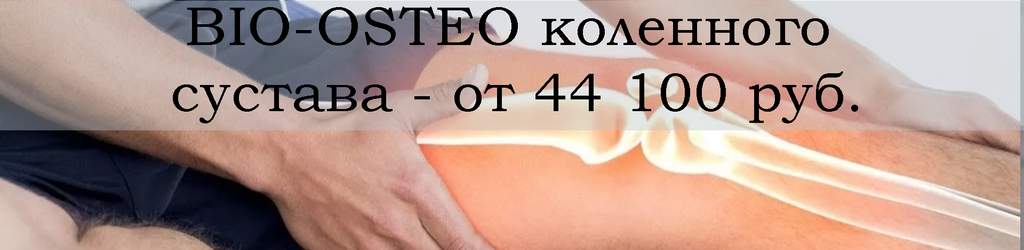 Биоимплант коленного сустава BIO-OSTEO от 44 100 руб.