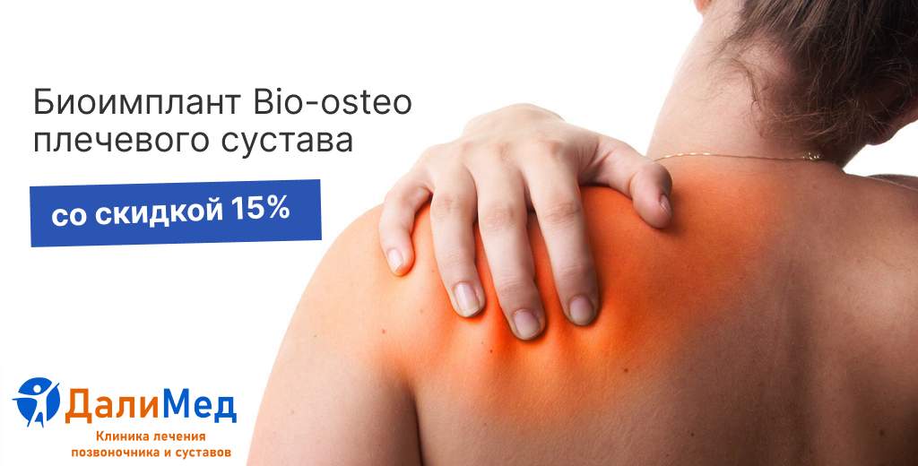 Биоимплант Bio-osteo плечевого сустава со скидкой 15%