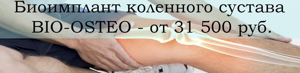 Биоимплант коленного сустава BIO-OSTEO от 31 500 руб.