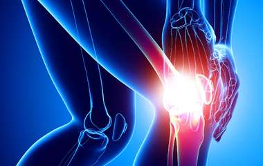Биоимплант коленного сустава