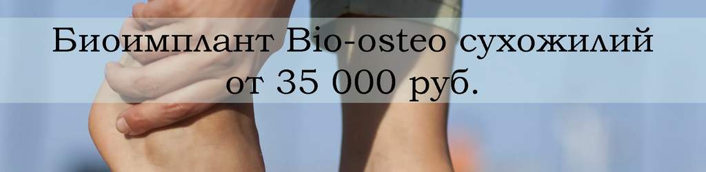 Биоимплант Bio-osteo сухожилий - со скидкой 50%