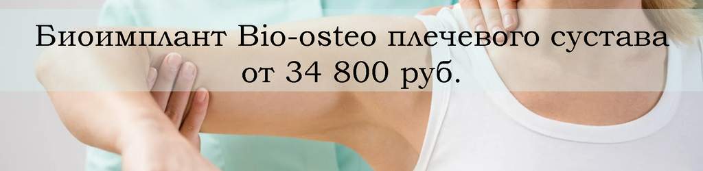 Биоимплант Bio-osteo плечевого сустава со скидкой 50%